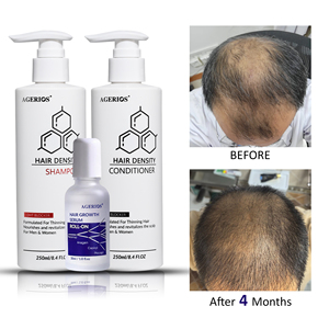 Traitement de densification capillaire sous marque privée : Sérum Redensyl roll-on avec shampoing et après-shampoing fortifiants pour des cheveux plus volumineux et plus épais - Product Image 1