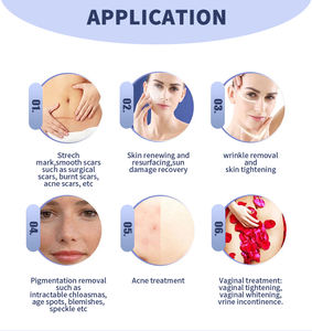 Appareil fractionnel 70W pour l'élimination des cicatrices, le renouvellement cutané, le rajeunissement du visage et le resserrement vaginal, <span class=keywords><strong>brosse</strong></span> de nettoyage corporel et faciale pour soins personnels - Product Image 3