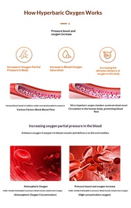 2ata <strong>Hyperbaric</strong> Oxygen <strong>Chamber</strong> Veterinary Human Pets HBOT Camera with the Help of Our Innovative Oxygen <strong>Chamber</strong> - Product Image 6