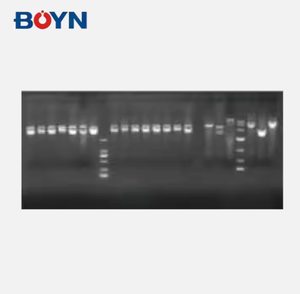 BNFIS-A 시리즈 자동 젤 영상 분석 시스템 형광/화학 발광 문서 실험실 영상 시스템 - Product Image 4