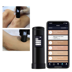 Machine d'analyseur de couleur de peau de marque de chine, vente en gros - Product Image 4
