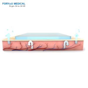 Lámina de silicona para cicatrices, parche médico de silicona en forma de ancla para eliminación de cicatrices en senos, queloides y cesáreas - Product Image 6