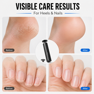 USB Rechargeable Portable Electric Nail <b>Grinder</b> Foot Callus Remover with LED Display for Nail Care Remove Callus - Product Image 4