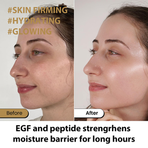 OEM ODM Réparation anti-rides Peau endommagée Ridules Peptide EGF intensif Crème raffermissante jour et nuit pour le visage - Product Image 5