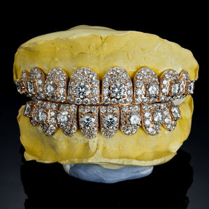 Rejilla Dental Personalizada de Plata S925 con Baño de Oro Rosa, con Incrustaciones de Moissanita VVS y Diamantes de Laboratorio con Corte Permanente, para Dientes - Product Image 1