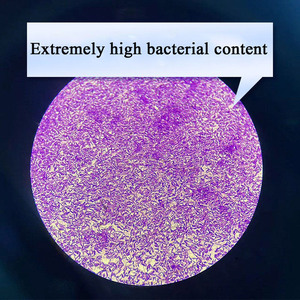 Bacterias Aeróbicas en Polvo de Alta Viabilidad ≥20B CFU/g para Tratamiento de Aguas Residuales Municipales, Impresión, Teñido y Alimentos - Product Image 2