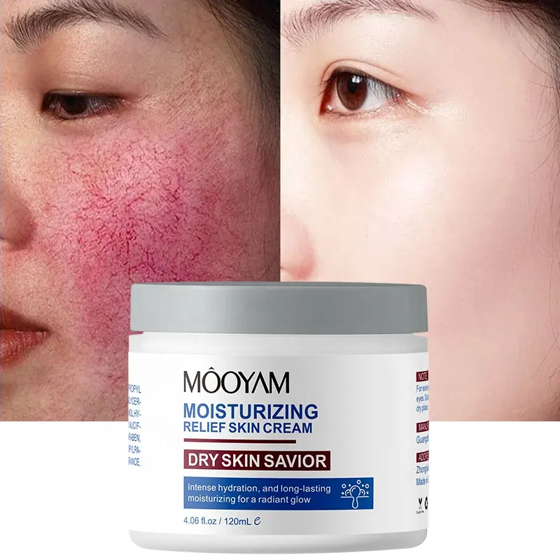 Crème réparatrice instantanée pour les rougeurs du visage Traitement apaisant Améliorer les soins de la peau sensible Hydratant