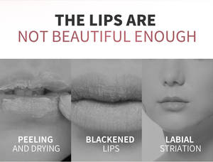 เซรั่มคอลลาเจนเพิ่มความชุ่มชื้น 5 มล. แบบหลอด ปริมาณมาก ไม่ทดลองกับสัตว์ พร้อมโลโก้ - Product Image 6