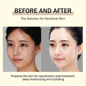 Crème pour le visage Crème pour <span class=keywords><strong>les</strong></span> <span class=keywords><strong>boutons</strong></span> dissolvant de <span class=keywords><strong>boutons</strong></span> Niacinamide Centella Beurre de karité Vitamine E Acide salicylique Carnosine - Product Image 3