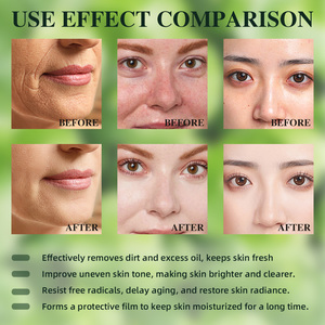 Tốt nhất bán tự nhiên chăm só<span class=keywords><strong>c</strong></span> da Bộ Arbutin Vitamin <span class=keywords><strong>C</strong></span> đốm đen mặt làm trắng da Bộ chăm só<span class=keywords><strong>c</strong></span> - Product Image 2