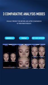 Thiết bị phân tích da với hình ảnh 3D và ánh sáng đa năng để chẩn đoán tình trạng da mặt và tạo báo cáo - Product Image 6