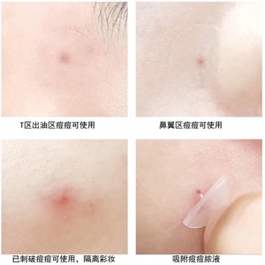Venta directa de fábrica de parches de acné de coloides acuosos de 24 piezas para día y noche, parches de acné invisibles de piel artificial, corrector. - Product Image 4