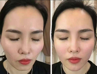 Sérum en poudre lyophilisée au peptide de cuivre GHK-Cu, anti-âge, réparation de la peau, stimulant de collagène, essence lyophilisée pour le soin du visage