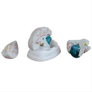 Modèles médicaux ADA ADA-304A/ADA-306 : Nouveaux modèles de cerveau et d'estomac pour la démonstration des maladies, outil pédagogique médical, Shanghai - Product Image 5