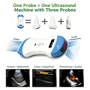 Sonda de Ultrasonido Portátil Inalámbrica 3 en 1 con Doppler Color JM-5CPL, Sonda Convexa, Lineal y de Fase, Escáner USG Médico Veterinario - Product Image 2
