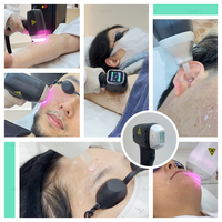 Nouvelle mise à jour 2024 : Appareil d'épilation laser à diode Millenium 1800W, Ice Titanium 3 ondes (755 1064), équipement de beauté laser modulable