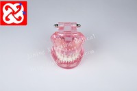 Pont de restauration de dents de maladie d'implant de modèle de Typodont dentaire standard pour le dentiste étudiant la Science médicale démontable de démo