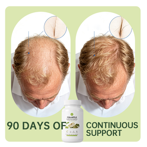 Suplemento Energético Herbal al por Mayor con Biotina de Alta Potencia Contra la Caída del Cabello - Product Image 3