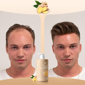 <span class=keywords><strong>Shampoo</strong></span> Crema allo Zenzero Naturale Biologico OEM Antiforfora Nutriente Antiprurito per la Crescita dei Capelli Formula 2-IN-1 Anticaduta con Olio di <span class=keywords><strong>Argan</strong></span> - Product Image 5