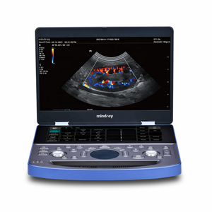 Mindray Vetus E7 Hoge Kwaliteit Goedkope Draagbare Kleur Doppler Veterinaire Hart Dier Echografie Voor Mens En Dierenarts Gebruik - Product Image 1