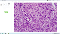 Bestscope BS-2084 Automatic Scanning Microscope with Compound Illuminating for Slide Pathology and Panoramic Scanning