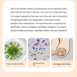 Lampe UV portable rechargeable USB 6W pour l'élimination des mycoses des ongles, en plastique, modèle LM25509, garantie 1 an - Product Image 6