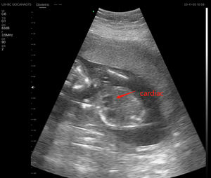 Escáner de Ultrasonido <span class=keywords><strong>Doppler</strong></span> Color Inalámbrico de Doble Sonda de Alta Rentabilidad - Product Image 6