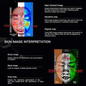 고품질 휴대용 얼굴 피부 분석 모니터 테스터 <span class=keywords><strong>3D</strong></span> 디지털 피부 분석기 - Product Image 2