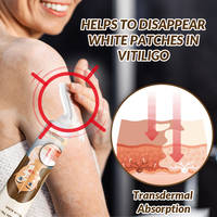 Traitement Sumifun pour le vitiligo : améliore les taches blanches de la peau, pommade pour soulager les taches blanches