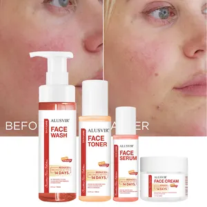 Reduce Redness Sensitive Skin Care Set Best Products Organic Natural Fast Soothe Repair Restore Skin Face Serum Skincare Set New