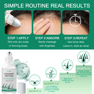 Vente flash - Sérum aux peptides de cellules souches Exo Ant-Chute de cheveux - Soin du cuir chevelu - EGF - Repousse des cheveux - Solution avancée de régénération des follicules pileux - Product Image 5