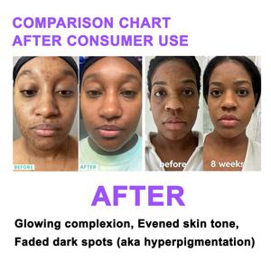 <span class=keywords><strong>DR</strong></span>.DAVEY Face Serum Iluminador Limpieza Puntos negros Crema facial para todo tipo de piel - Product Image 2