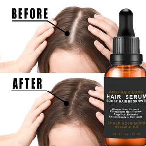 Croissance des cheveux Huile essentielle Rapide Efficace Bio gingembre soin des cheveux pour cuir chevelu nourrissant anti perte sérum réparateur pour hommes et femmes - Product Image 5