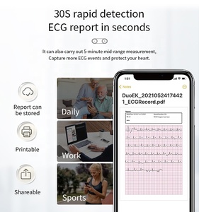 เครื่องบันทึกคลื่นไฟฟ้าหัวใจแบบพกพา ECG/EKG ชนิดสวมใส่ได้ตลอด 24 ชั่วโมง พร้อมระบบวิเคราะห์ด้วย AI รุ่น DuoEK S เครื่องตรวจคลื่นไฟฟ้าหัวใจแบบพกพา อุปกรณ์ตรวจคลื่นไฟฟ้าหัวใจแบบเคลื่อนที่ - Product Image 4