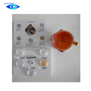 Modelo de ojo humano de catarraco para ciencia médica, modelo de ojo anatómica - Product Image 6