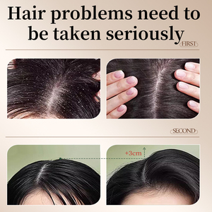 แชมพูสระ<span class=keywords><strong>ผม</strong></span>สกัดจาก Astragalus ช่วยให้ผมแห้งและหลุดร่วงกลิ่นหอมติดทนนานบำรุงอย่างล้ำลึกเพื่อความนุ่มเนียน - Product Image 5