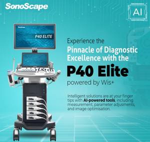 Ecógrafo Digital 4D <span class=keywords><strong>5D</strong></span> Sonoscape P40 Elite, Carro de Diagnóstico OB/GYN, Máquina de Ultrasonido Doppler a Color - Product Image 1