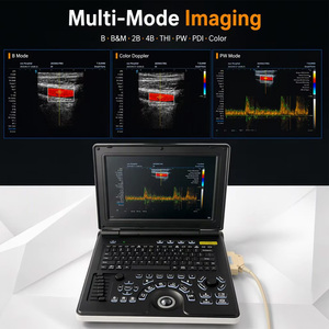 Système d'échographie <span class=keywords><strong>Doppler</strong></span> couleur portable pour animaux, scanner d'échographie portable pour cardiologie animale et échographie des petits animaux - Product Image 5
