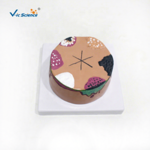 बच्चों के लिए त्वचा कैंसर शारीरिक शिक्षा मॉडल मैनिकिन प्लास्टिक/पीसी - Product Image 1