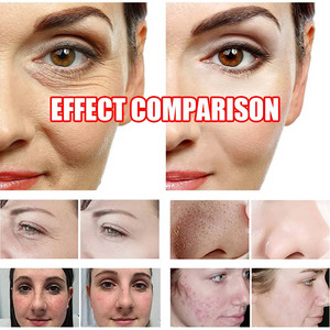 Máquina Facial Profesional de Hidrobelleza 17 en 1, Purificadora, Revitalizante y Limpiadora de la Piel, NF-17IN1, Máquina Hidra para la Piel de Alta Calidad - Product Image 1