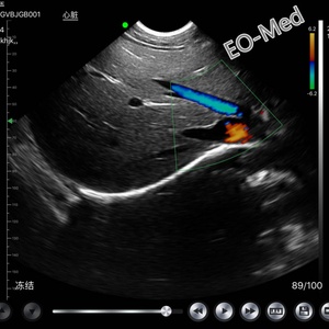 เครื่องสแกนอัลตราซาวนด์ โซโนสเคป พร้อมหัวตรวจแบบไมโครคอนเว็กซ์ รุ่น CU15 - Product Image 6