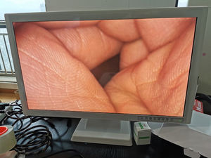 Sistema de câmera Professinal médico CMOS Endoscopia HD/4K Set/Endoscopy Tower - Product Image 5