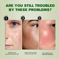 Sérum Visage et Cou à la Niacinamide et à l'Acide Hyaluronique, Éclaircit, Réduit les Taches, Contrôle le Sébum, Répare la Barrière Cutanée, Hydrate, 40g, Utilisation Quotidienne
