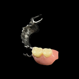 Prothèse avancée d'alliage de chrome de cobalt avec la technologie de moulage de précision - Product Image 2