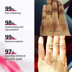 Fabrication de crème pour le corps à l'acide kojique pour réduire les cicatrices, éliminer les taches brunes, unifier le teint, produits cosmétiques, usine OEM/ODM - Product Image 3