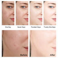 Produits de soin de la peau coréens, crème pour le visage au collagène et à l'arbutine, avec de la niacinamide pour les peaux jaunes - hydratante et anti-âge