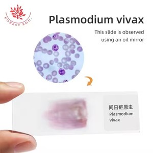 Биологические лабораторные слайды для медицинского обучения Plasmodium <span class=keywords><strong>Vivax</strong></span>, высокообразовательный исследовательский микроскоп, подготовленные слайды - Product Image 2