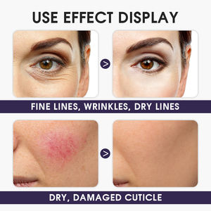 Kırışıklık azaltma günlük cilt gençleştirme ince çizgiler için Retinol ile WANXI kollajen yüz kremi Anti-Aging güç merkezi - Product Image 5