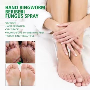Herbal <span class=keywords><strong>Natural</strong></span> Eficaz para la reparación de hongos en las uñas Crema para el pie para la eliminación de hongos en las uñas Ungüento y aerosol Suministro de atención médica - Product Image 3