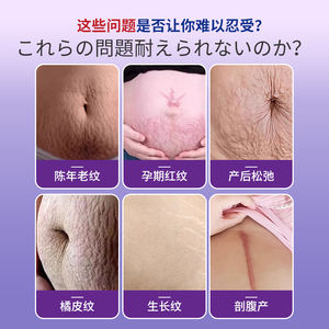इवाशी जैकसन फार्मास्युटिकल चाइनीज़ प्लास्टर पोस्टपार्टम खिंचाव के निशान की वृद्धि चिह्न जांघ मजबूत पेट की चर्बी - Product Image 3
